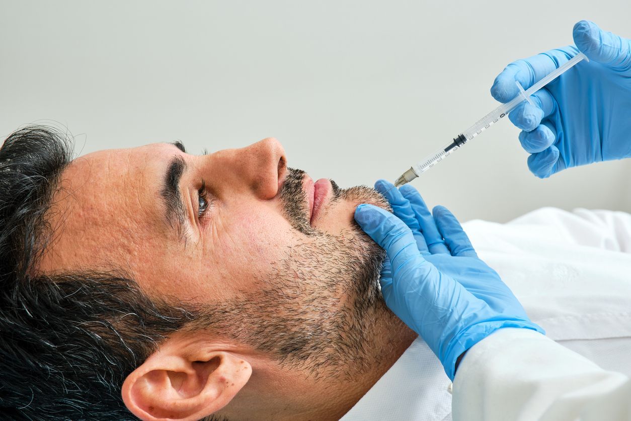 Chin filler treatment